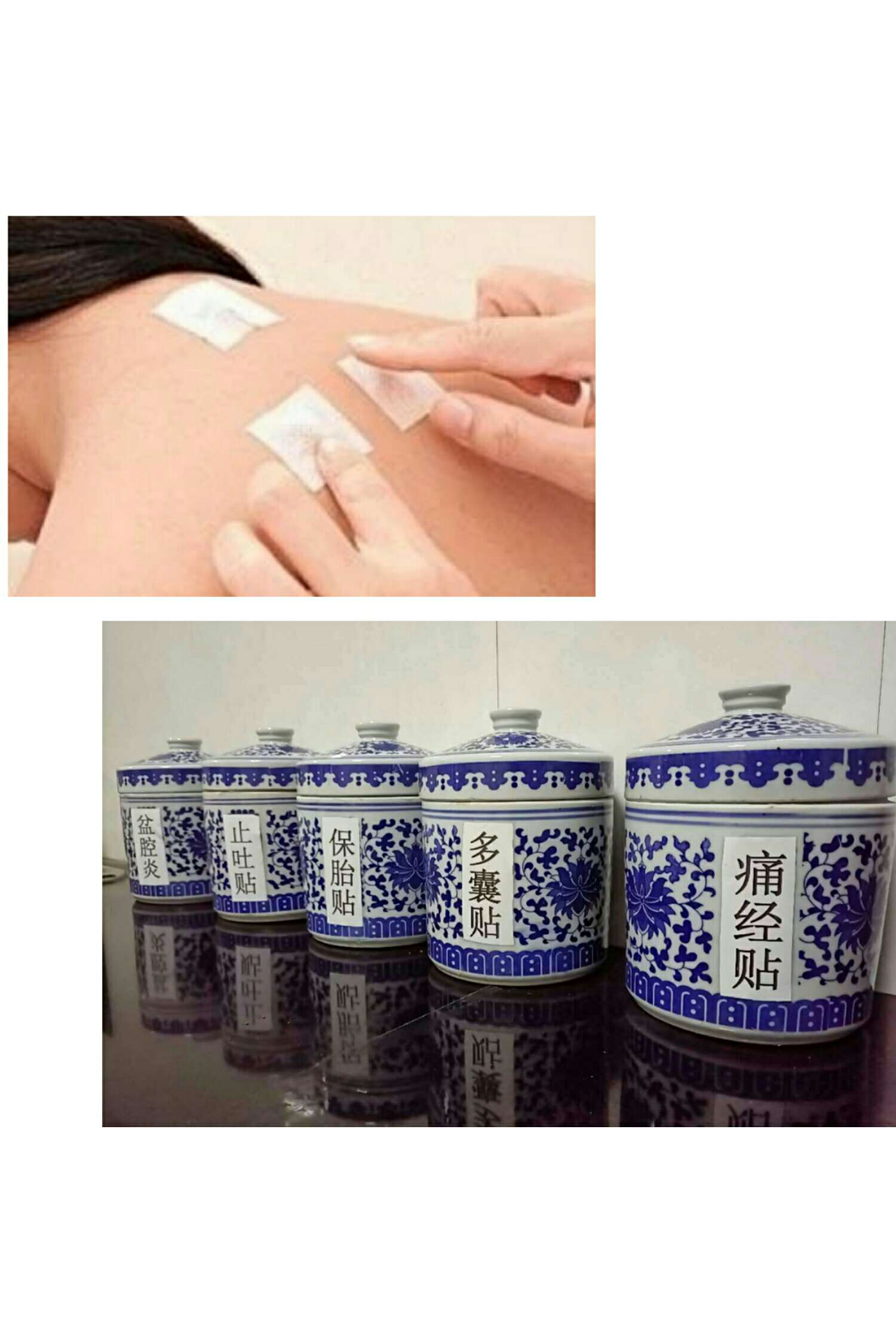 1、三伏貼能治什么?。? style=