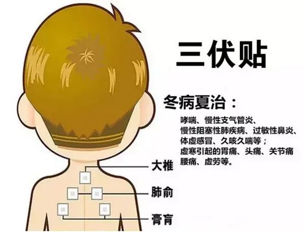 2、三伏貼的功能和功效是什么？