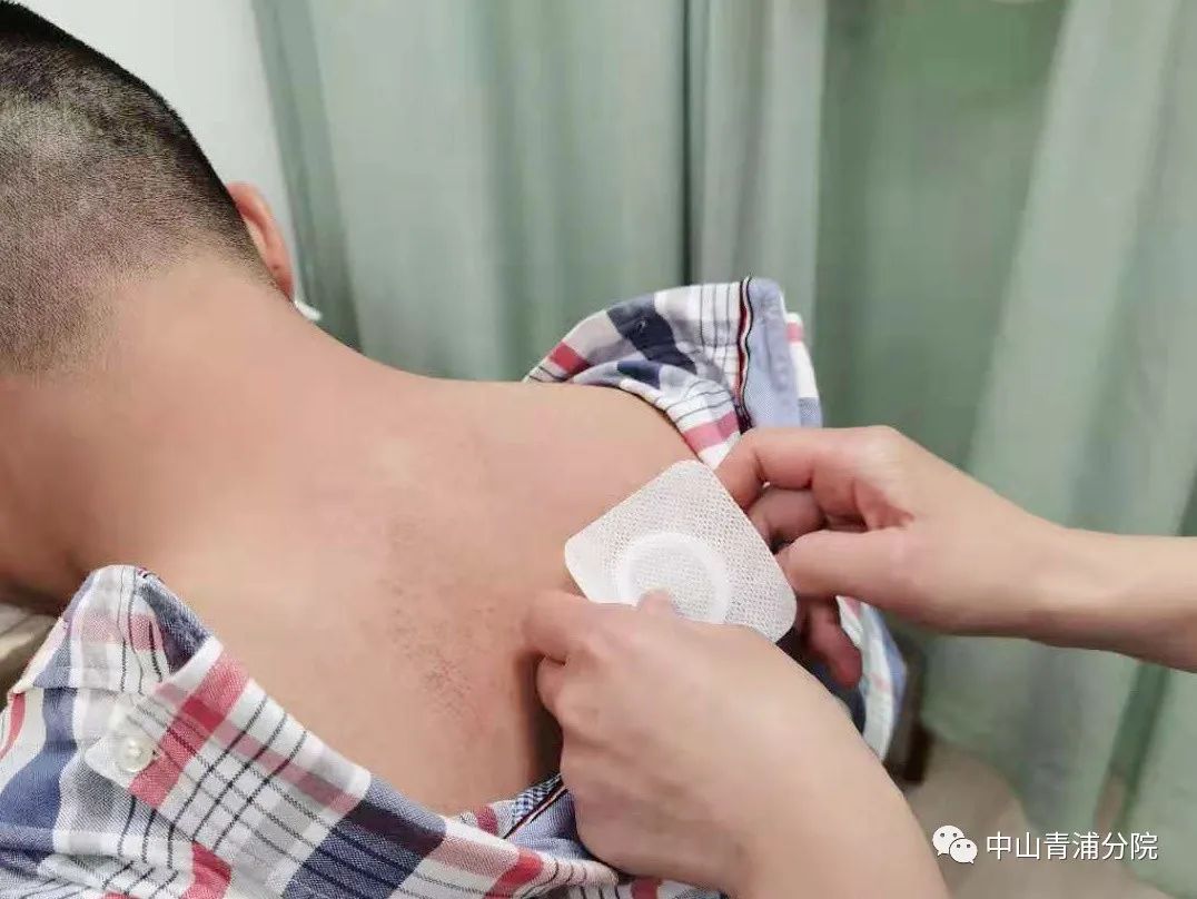 2、江西兒童貼三伏貼癢灼痛，什么體質(zhì)的人可以貼三伏貼癢灼痛？