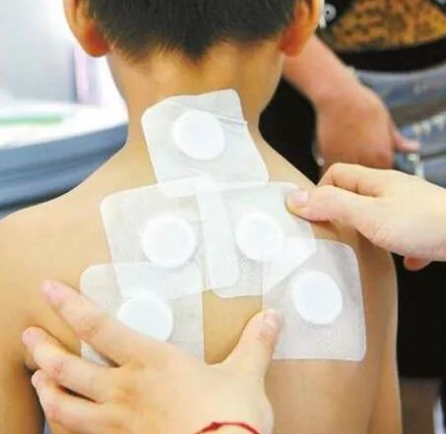 2、三伏貼在脖子上，有一根針，看起來很疼。怎么了